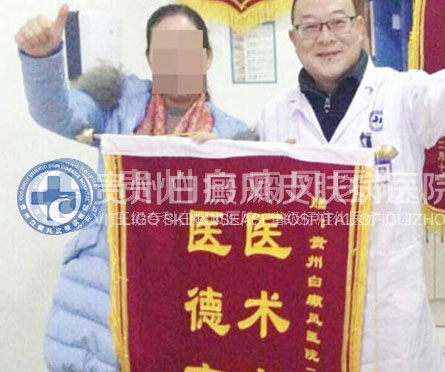 白斑比山重 治愈展笑颜